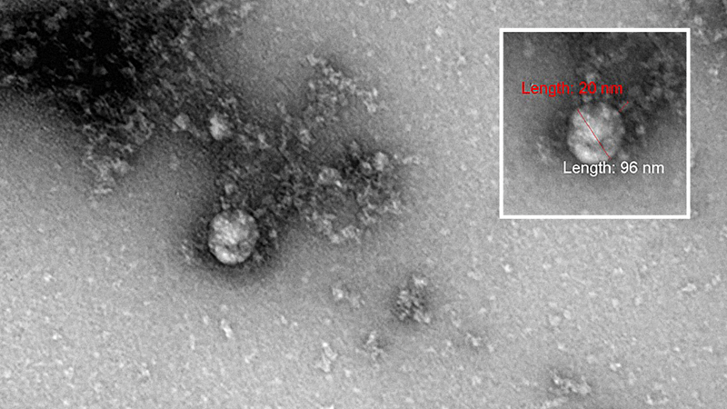 Hình ảnh một hạt virus của biến thể SARS-CoV-2 mới ở Anh được phân lập từ một bệnh nhân hồi tháng 12-2020. Ảnh: rospotrebnadzor.ru